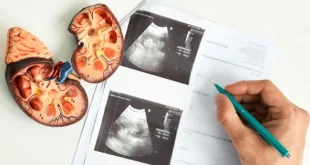 5 Gejala Awal Ginjal Rusak yang Sering Tidak Disadari