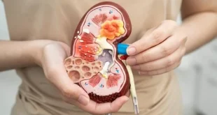 7 Makanan yang Membuat Ginjal Bekerja Keras dan Dampaknya
