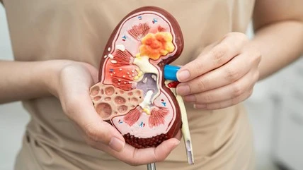 7 Makanan yang Membuat Ginjal Bekerja Keras dan Dampaknya