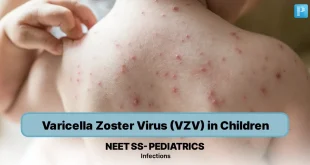 Panduan Lengkap Infeksi Primer VZV pada Anak dan Pencegahannya