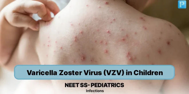 Panduan Lengkap Infeksi Primer VZV pada Anak dan Pencegahannya